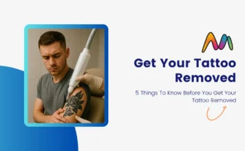 5 Things To Know Before You Get Your Tattoo Removed tattoo removal
