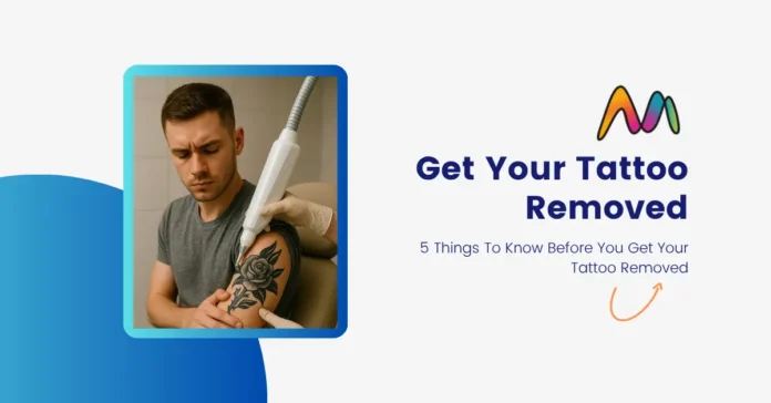 tattoo removal