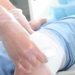 oxygen-wound-therapy