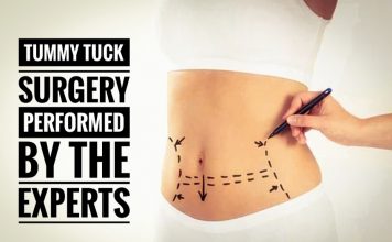 What is Abdominoplasty? How this surgery is performed by the experts? Abdominoplasty