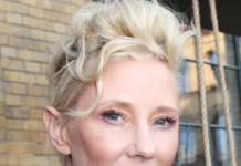 Anne Heche āNot Expected to Surviveā image