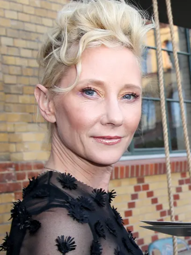 Anne Heche “Not Expected to Survive”