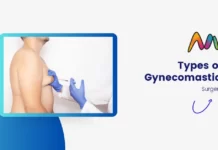 Types of Gynecomastia: Which One is Right for You? Types of Gynecomastia Surgery