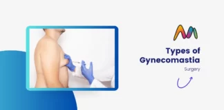 Types of Gynecomastia: Which One is Right for You? Types of Gynecomastia Surgery