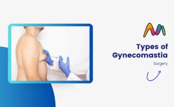 Types of Gynecomastia: Which One is Right for You? Types of Gynecomastia Surgery