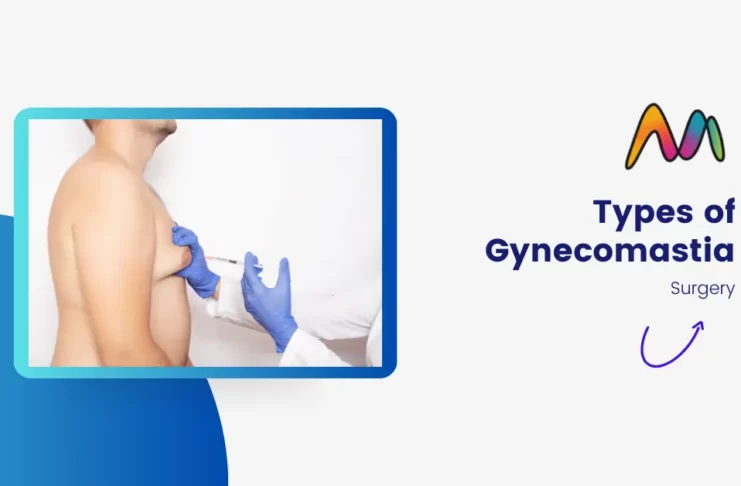 Types of Gynecomastia Surgery